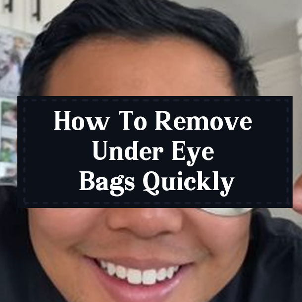 How To Remove Under Eye Bags Quickly