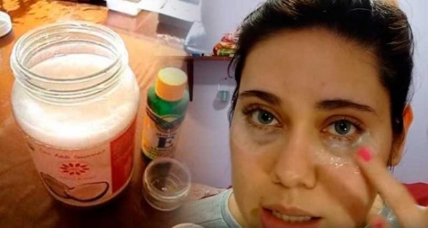I Feel 5 Years Younger – An Eye Cream Made of 3 Ingredients: It Erases the Wrinkles Like With a Rubber! - picture 2