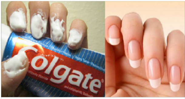 I Never Thought Toothpaste Could Help Me In Ways Beyond My Teeth! Check These 20 Amazing Tricks! - picture 2