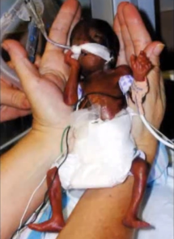 If Her Mother Hadn't Lied, No Doctor Would Have Brought This Baby Into The World... - picture 2