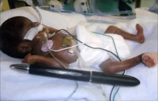 If Her Mother Hadn't Lied, No Doctor Would Have Brought This Baby Into The World... - picture 3