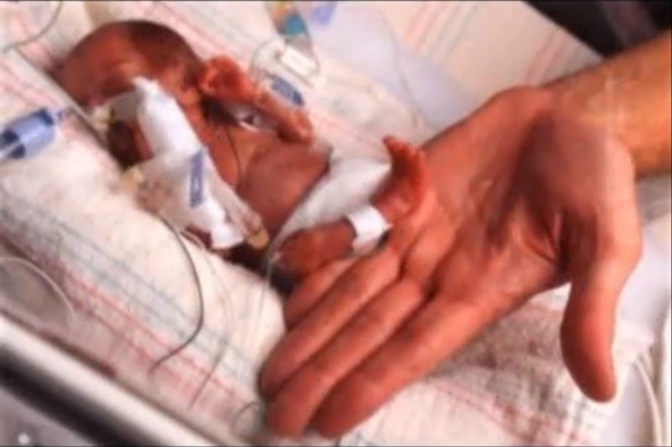 If Her Mother Hadn't Lied, No Doctor Would Have Brought This Baby Into The World... - picture 4