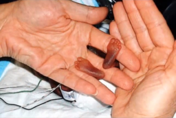 If Her Mother Hadn't Lied, No Doctor Would Have Brought This Baby Into The World... - picture 5