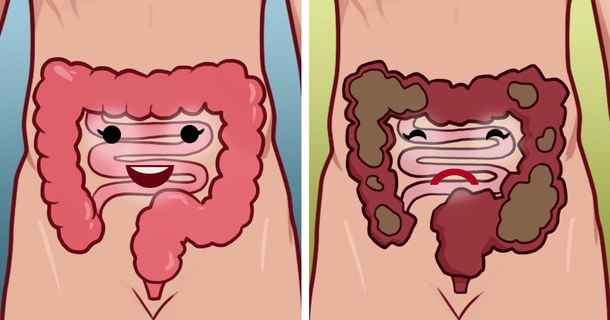 If You Are Feeling Bloated Or Backed Up, Here's What You Need To Know - picture 2