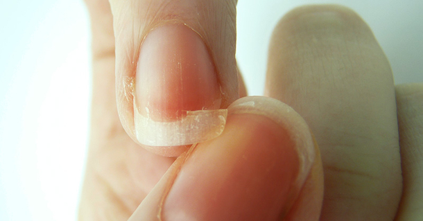 If you are suffering from a lack of sleep and brittle nails, these foods will help - picture 2