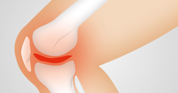 If you are suffering from knee pain or know someone who is, you'll have to try this technique - picture 2