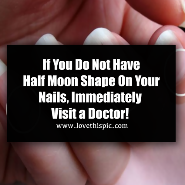 If You Do Not Have Half Moon Shape On Your Nails, Immediately Visit a Doctor!