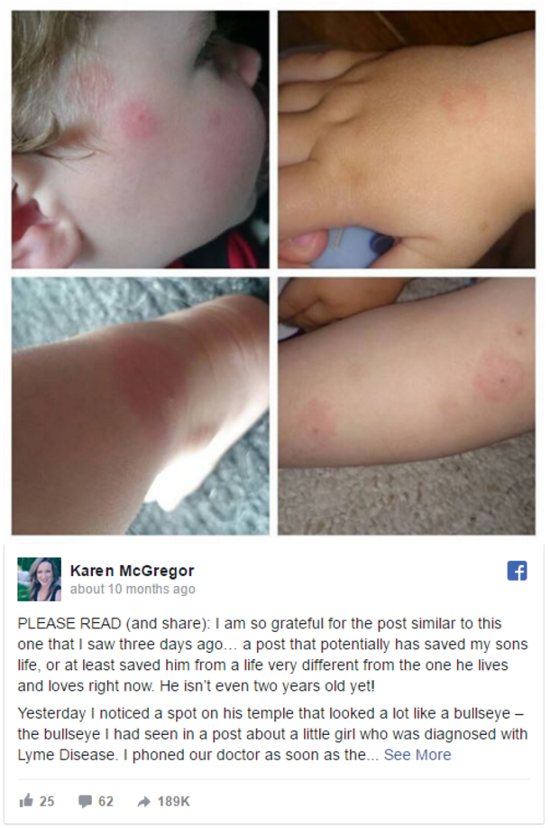 If You Ever Notice A Mark Like This On Your Kid, Do Not Hesitate To Rush Them To The ER. Here’s Why - picture 3