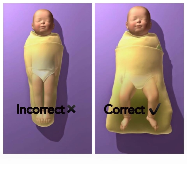 If You EVER See A Baby Swaddled Like This, UNWRAP THEM Immediately — Here’s Why - picture 2