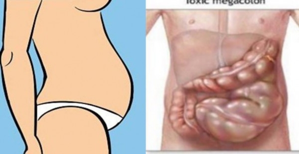 If You Have A Bloated Stomach, You Aren't Fat! Here Is How You Get Rid Of That Fast! - picture 2