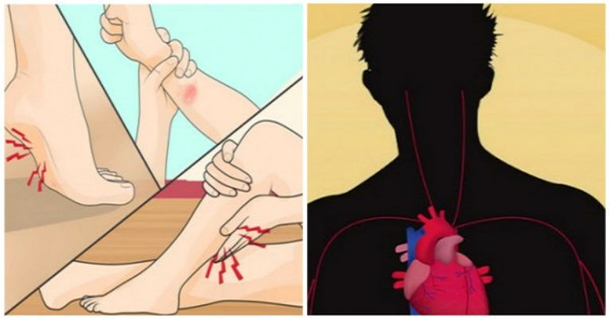 If You Have Any Of These Symptoms, You Could Have Low Magnesium Levels - picture 2