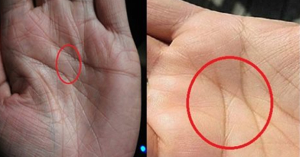 If You Have The Letter 'X' In The Palm Of Your Hand, It Means Something Special, Only 3% Of People Have It - picture 2