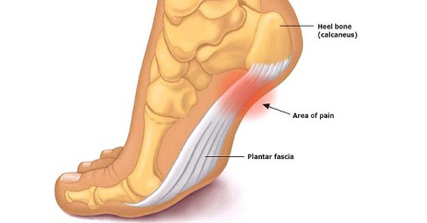 If You Or Your Kids Wear THESE Shoes You Need To Take Them Off RIGHT NOW! Here's Why... - picture 4