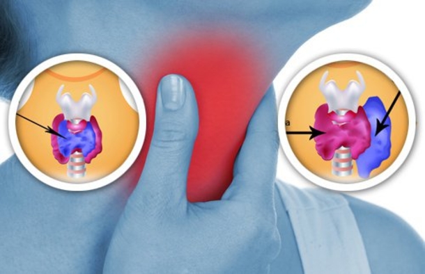 If You Rub Red Onion On Your Neck, You Will Receive Some AMAZING Benefits. WOW! - picture 4