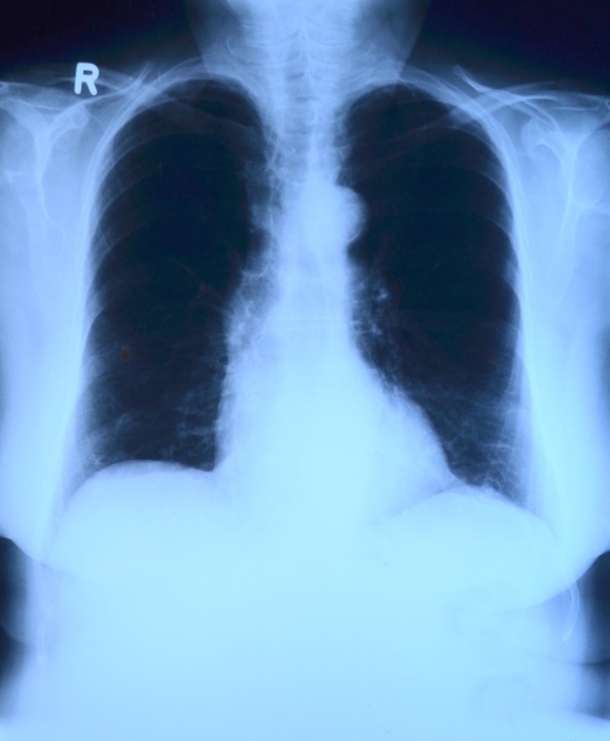 If You Smoke This Easy To Make Recipe Will Clear Your Lungs - picture 5