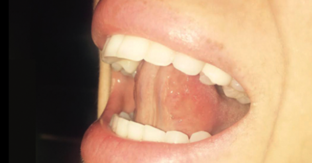 If You Touch The Roof Of Your Mouth Using Your Tongue And Breathe; This Amazing Effect Happens To Your Body - picture 3