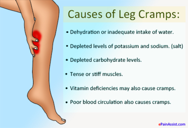 If Your Legs Cramp, This Is The Reason Why And How To Prevent It From Happening Again - picture 3