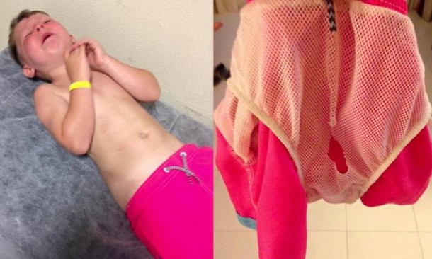 If Your Son Wears Swimming Shorts Like THIS, You Need To Check Them IMMEDIATELY. Here’s Why! - picture 2