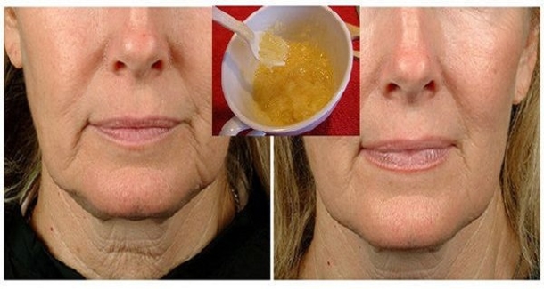 In 10 Days You Can Have Younger & Nourishing Looking Skin With This Homemade Mask! - picture 2