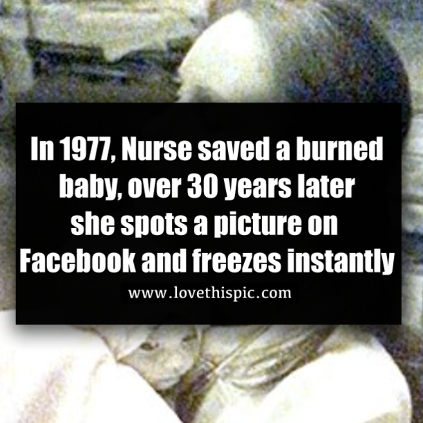 In 1977, Nurse saved a burned baby, over 30 years later she spots a picture on Facebook and freezes instantly
