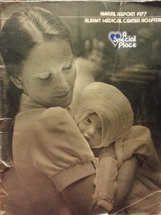 In 1977, Nurse saved a burned baby, over 30 years later she spots a picture on Facebook and freezes instantly - picture 3