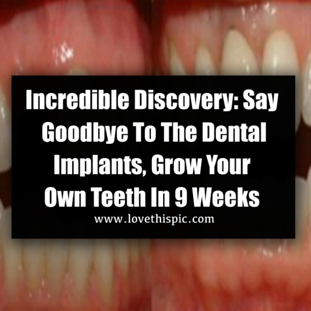Incredible Discovery: Say Goodbye To The Dental Implants, Grow Your Own Teeth In 9 Weeks