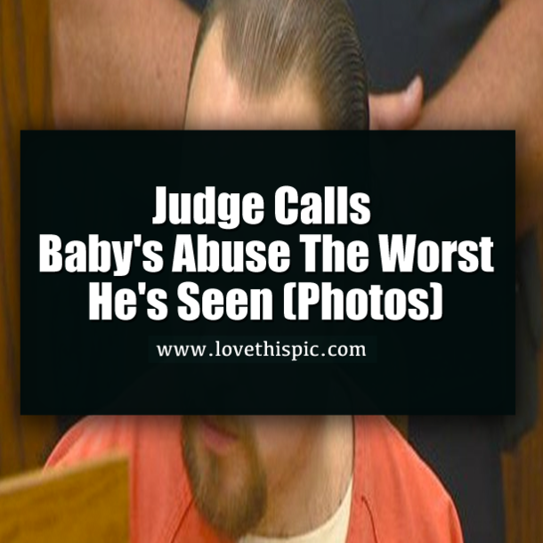 Judge Calls Baby's Abuse The Worst He's Seen