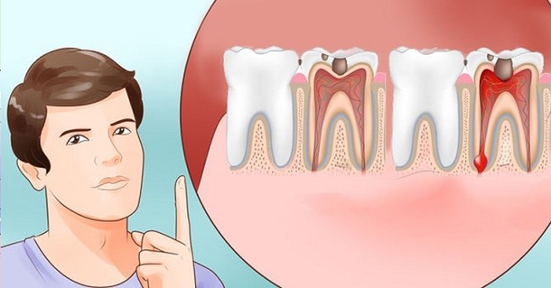 Just By Putting This Thing In Your Mouth Toothache Pain Will Vanish In Seconds - picture 2