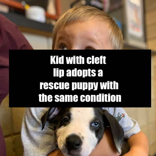 Kid with cleft lip adopts a rescue puppy with the same condition