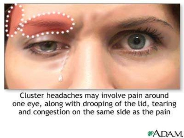 Learn How Headaches Can Reveal What is Wrong With Your Health (And How To Cure Them Naturally) - picture 4
