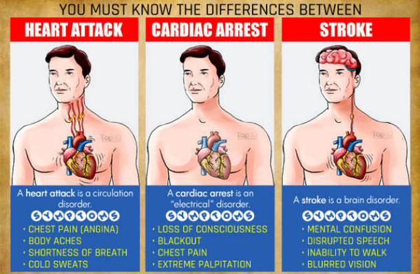 Learn The Differences Between A Heart Attack, Cardiac Arrest And Stroke...It Could Save Your Life! - picture 2