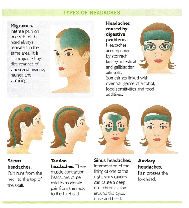 Learn The Different Types Of Dangerous And Serious Headaches... - picture 4