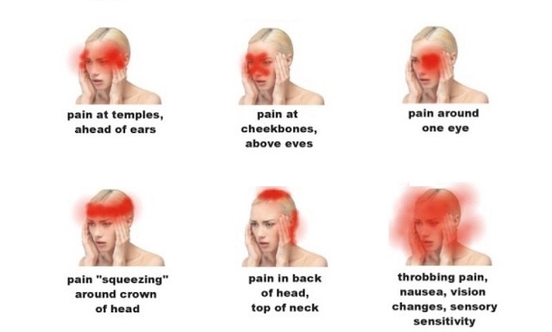 Learn The Different Types Of Dangerous And Serious Headaches... - picture 5