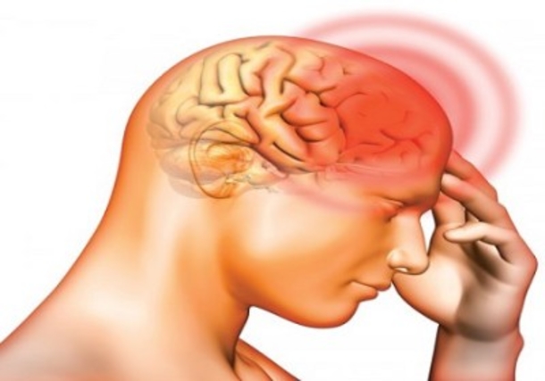 Learn The Different Types Of Dangerous And Serious Headaches... - picture 7
