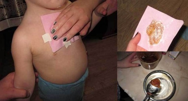 Learn This Highly Efficient Way for Getting Rid of Coughs and Lung Mucus! - picture 2