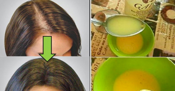 Leave All Doctors Surprised: Apply This Remedy and Your Hair Will Grow Faster Than Ever - picture 2