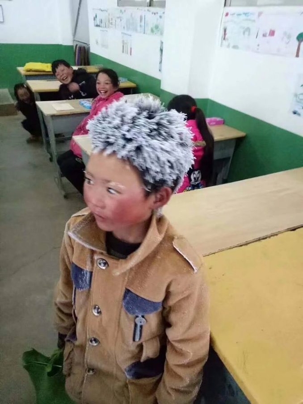 Little 8-Year-Old Boy Shows Up To School With Frozen Head, Teacher Sees Something & Heart Breaks - picture 3