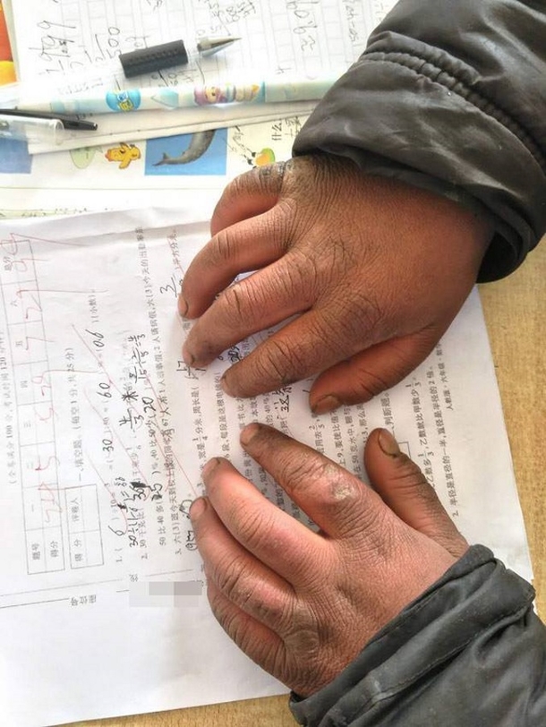 Little 8-Year-Old Boy Shows Up To School With Frozen Head, Teacher Sees Something & Heart Breaks - picture 4