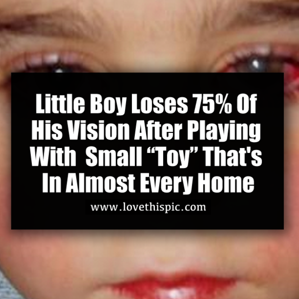 Little Boy Loses 75% Of His Vision After Playing With Small “Toy” That's In Almost Every Home
