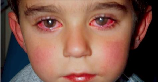 Little Boy Loses 75% Of His Vision After Playing With Small “Toy” That's In Almost Every Home - picture 2