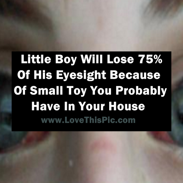 Little Boy Will Lose 75% Of His Eyesight Because Of Small Toy You Probably Have In Your House