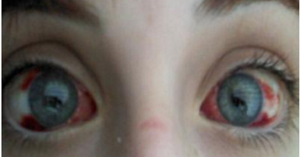 Little Boy Will Lose 75% Of His Eyesight Because Of Small Toy You Probably Have In Your House - picture 2