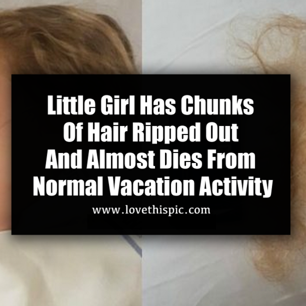 Little Girl Has Chunks Of Hair Ripped Out And Almost Dies From Normal Vacation Activity