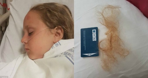 Little Girl Has Chunks Of Hair Ripped Out And Almost Dies From Normal Vacation Activity - picture 2