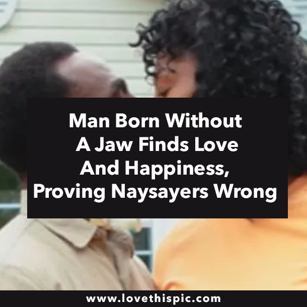 Man Born Without A Jaw Finds Love And Happiness, Proving Naysayers Wrong