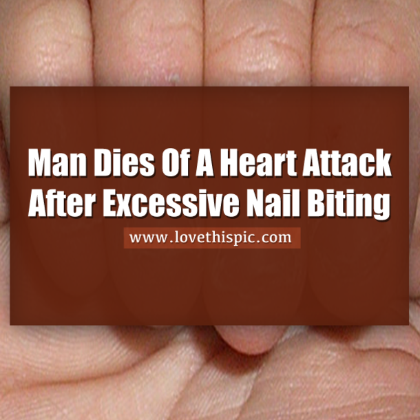 Man Dies From Severe Nail Biting Habit; Doctor Issues Warning To Others...