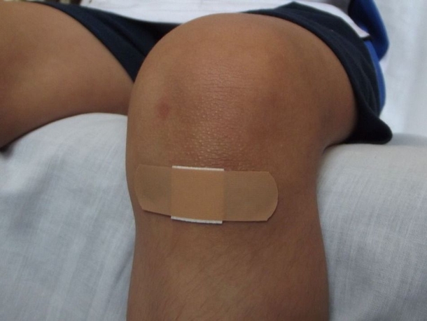 Man Nearly Dies After Getting Sick From Biting His Nails - picture 5