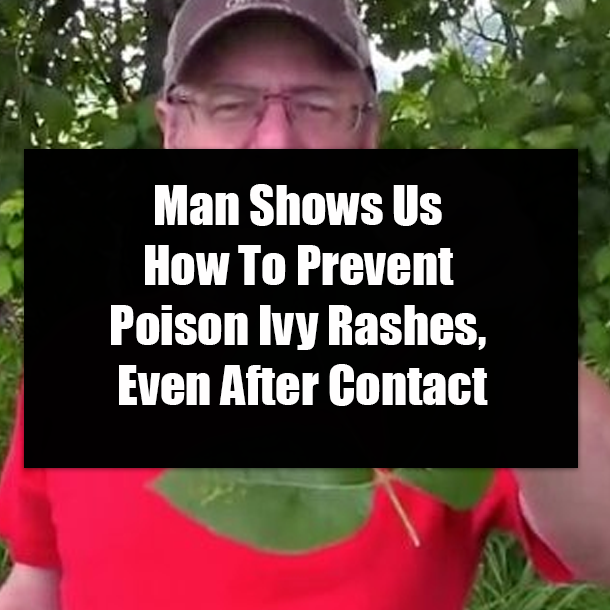 Man Shows Us How To Prevent Poison Ivy Rashes, Even After Contact