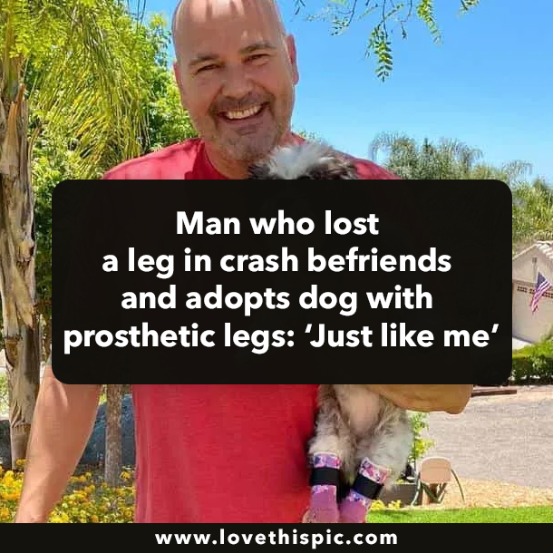 Man who lost a leg in crash befriends and adopts dog with prosthetic legs: ‘Just like me’