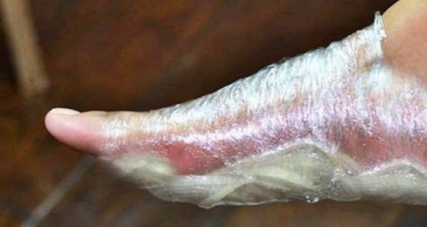Many Diseases Come Through Your Feet. Here’s How To Do Your Body A Big Favor And Detoxify It From Toxins - picture 5